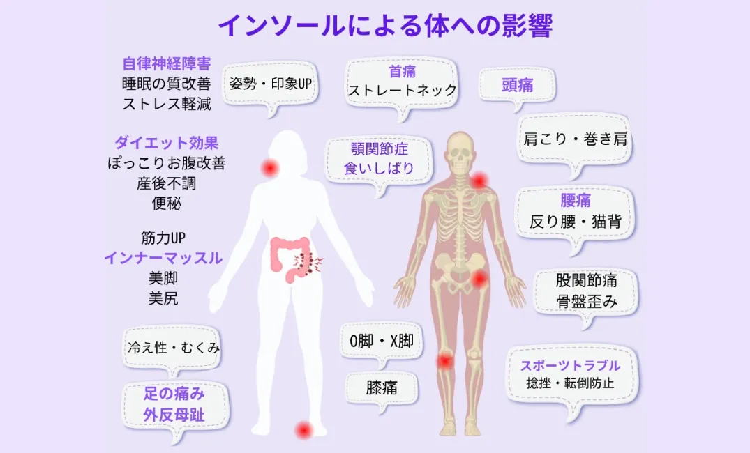 外反母趾にオーダーメイドインソール｜沖縄那覇